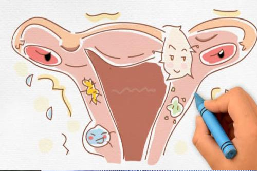 宫颈炎的危害有哪些 宫颈炎的危害有哪些