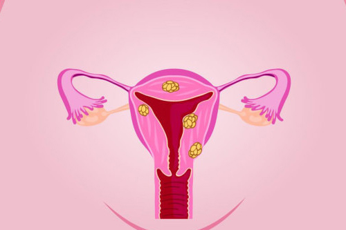 宫颈糜烂影响怀孕吗 宫颈糜烂影响怀孕吗