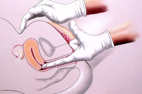 妇科检查疼吗全过程