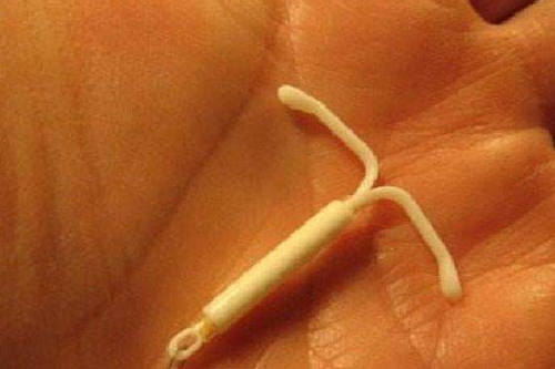 宫颈糜烂能上节育环吗 宫颈糜烂能上节育环吗